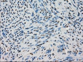 BUB1B / BubR1 Antibody (clone OTI3D9)