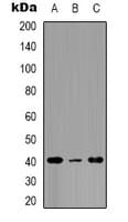 PTGER2 / EP2 Antibody (C-Terminus)