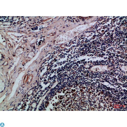 Polyclonal Rabbit anti-Human ITGAE / CD103 Antibody (WB)