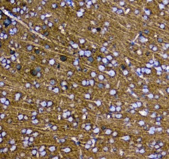 Polyclonal Rabbit anti-Human SYT1 / Synaptotagmin Antibody (IHC, WB)