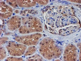 VCAM1 / CD106 Antibody (clone OTI4E8)