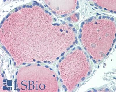 IHC-plus™ IGFBP6 Antibody