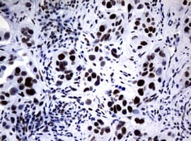 NBN / Nibrin Antibody (clone OTI2E9)