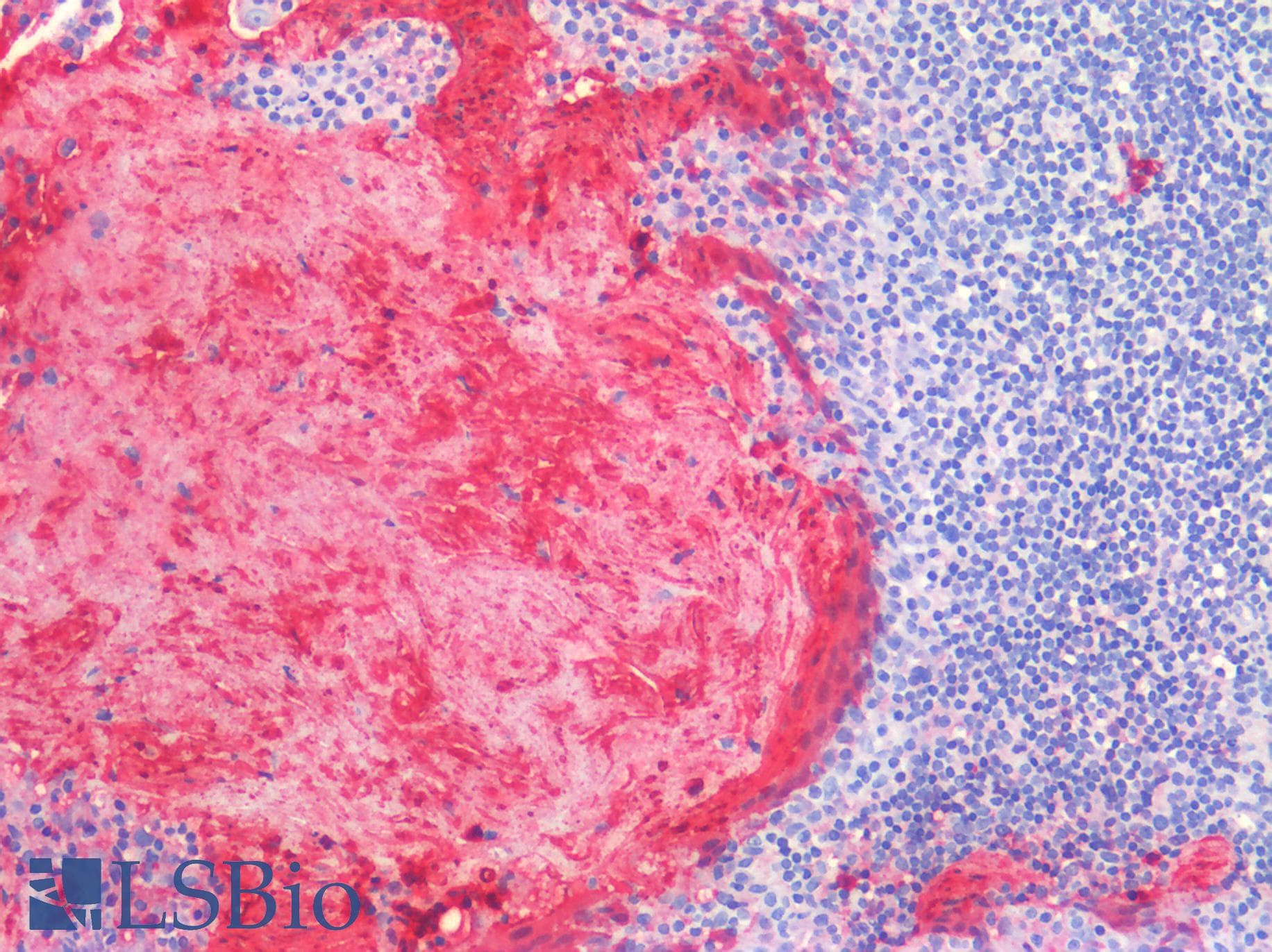 PathPlus™ Monoclonal Mouse anti-Human S100A8 / MRP8 Antibody (clone MAC 387, Azide-free, IHC)