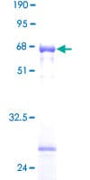 Human HSD17B6 Protein (Recombinant GST)