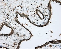 BTK Antibody (clone OTI6H9)