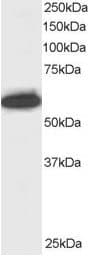IHC-plus™ Polyclonal Goat anti-Human NUP50 Antibody (aa429-440, IHC, WB)