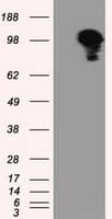 ERIC-1 / TACC3 Antibody (clone OTI6C6)