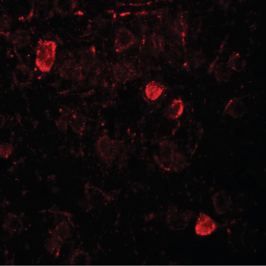 NSMF / NELF Antibody
