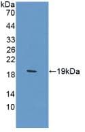 CA12 / Carbonic Anhydrase XII Antibody (aa154-307, Biotin)