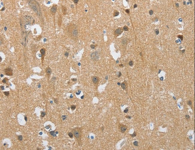 PITX3 Antibody