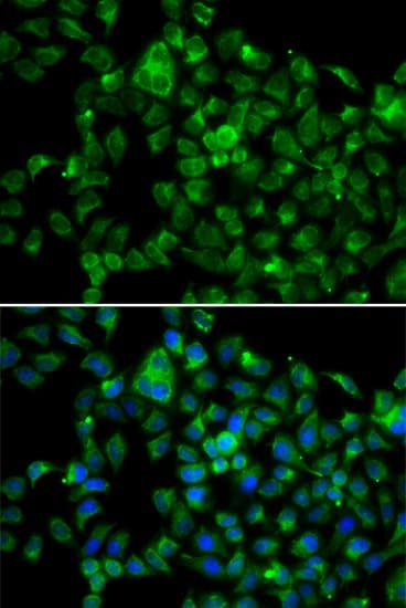 Polyclonal Rabbit anti-Human NAT8B Antibody (IHC, IF, WB)