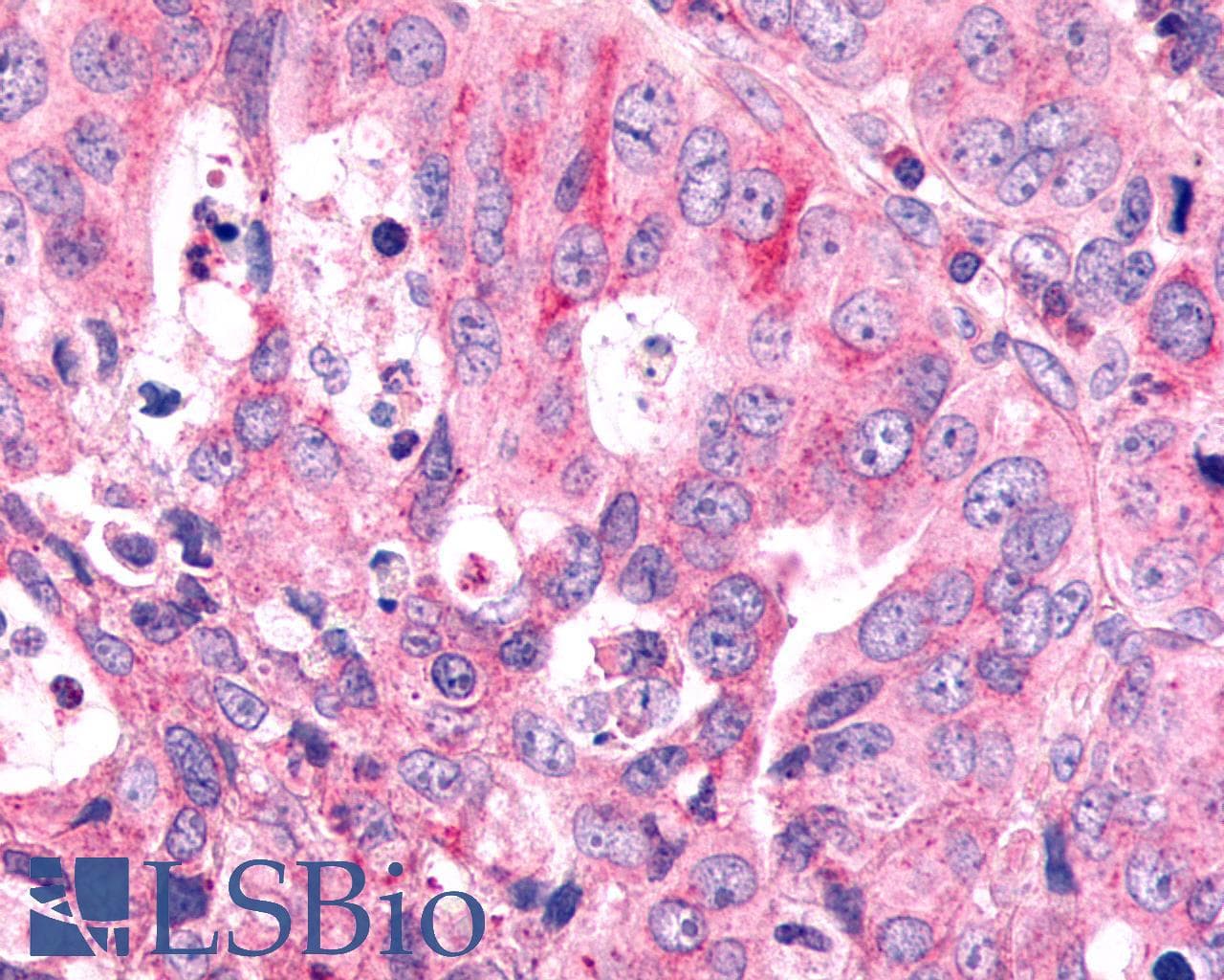 PathPlus™ Polyclonal Rabbit anti-Human FZD6 / Frizzled 6 Antibody (N-Terminus, IHC)