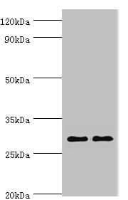 Polyclonal Rabbit anti-Human SPIN2B Antibody (aa1-258, IHC, WB)