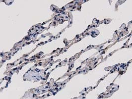 SULT1A1 / Sulfotransferase 1A1 Antibody (clone OTI2C5)