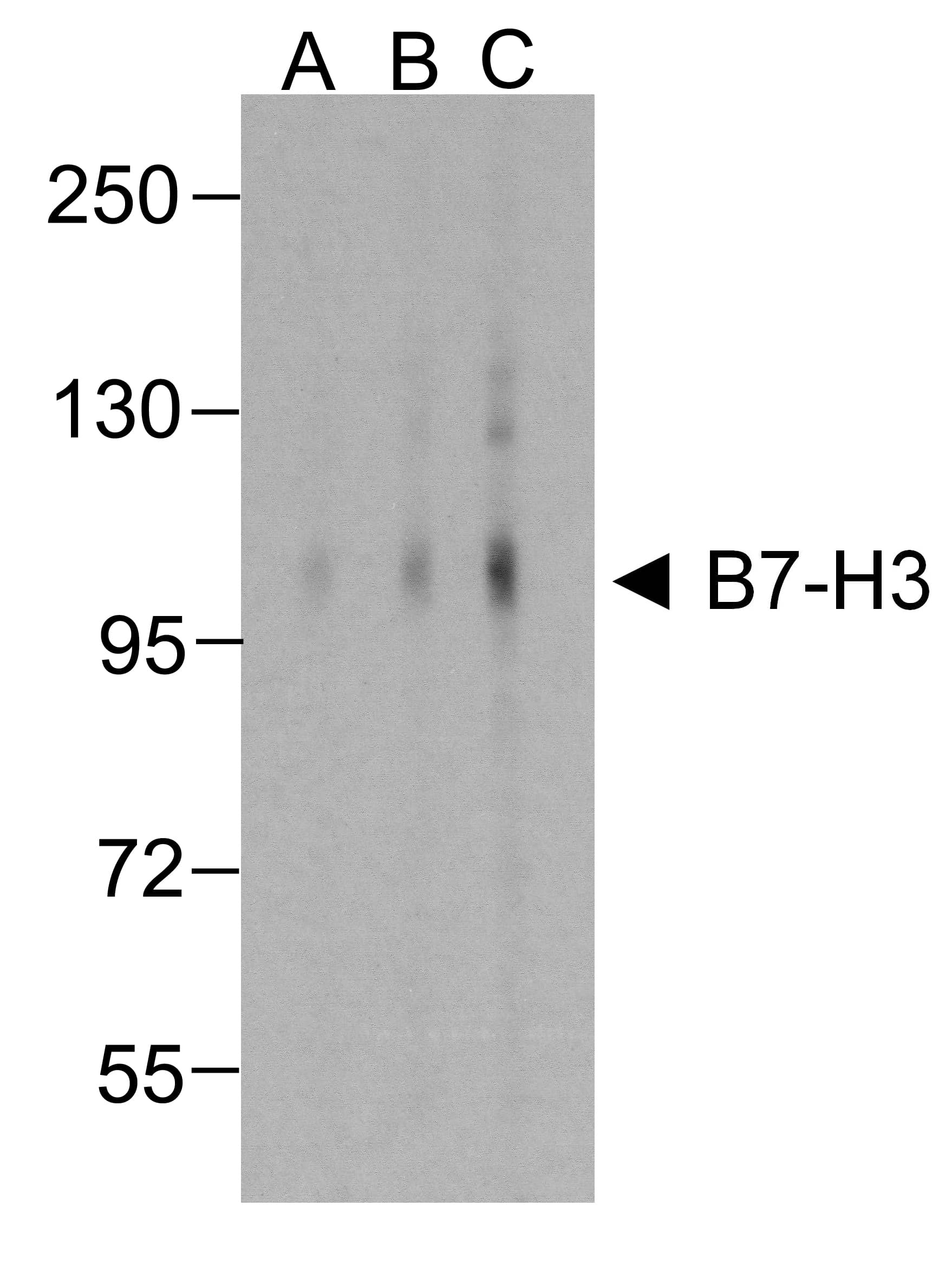 CD276 / B7-H3 Antibody (clone 2H5)