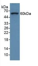 COL8A1 / Collagen VIII Alpha 1 Antibody (aa590-744, FITC)