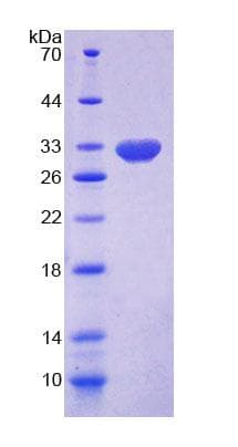 Human HSD17B14 Protein (Recombinant His-T7)