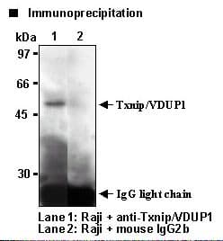 TXNIP Antibody (clone JY1)