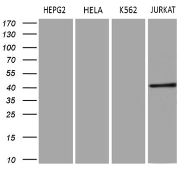 ERLIN1 / SPFH1 Antibody (aa107-346, clone OTI4C11)