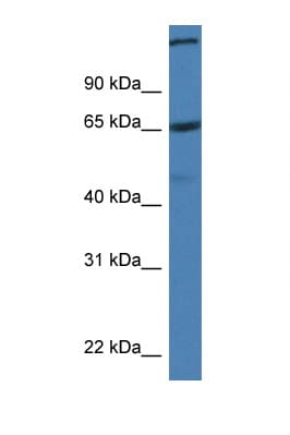 Polyclonal Rabbit anti-Mouse ST6GALNAC1 Antibody (aa450-499, WB)