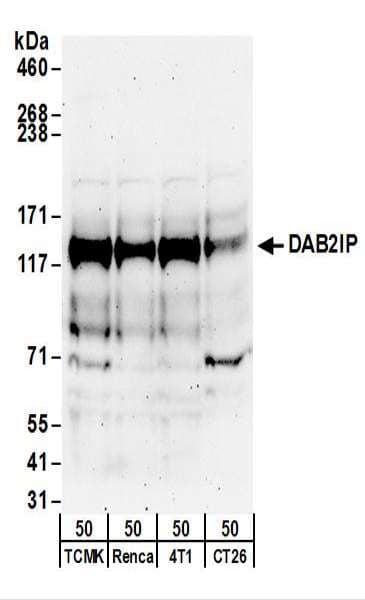 Polyclonal Rabbit anti-Human DAB2IP Antibody (aa850-900, WB)