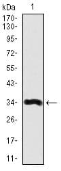 LPA / Lipoprotein a Antibody (clone 4H1)