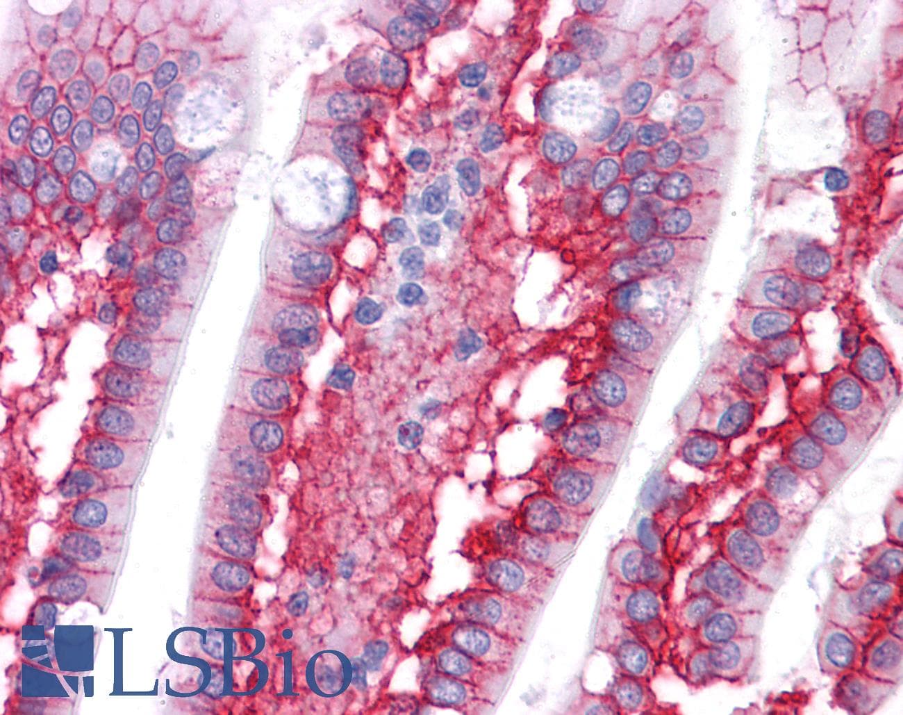 PathPlus™ CTNNB1 / Beta Catenin Antibody (clone EM-22)