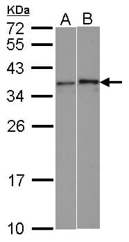 WBSCR22 Antibody (aa1-263)
