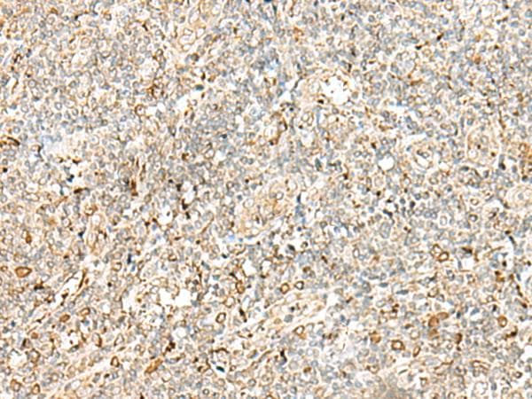 Polyclonal Rabbit anti-Human PDIA4 / ERP72 Antibody (IHC, WB)
