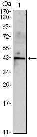 INHA / Inhibin Alpha Antibody (clone 400)