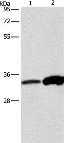 Polyclonal Rabbit anti-Human ANXA4 / Annexin IV Antibody (IHC, WB)