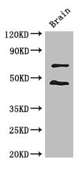 HSPC167 / CDK5RAP1 Antibody