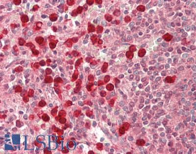 IHC-plus™ IRAK3 / IRAKM / IRAK-M Antibody