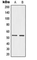 TP53 / p53 Antibody (phospho-Ser15)