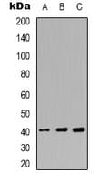HNRNPC / HNRNP C Antibody (C-Terminus)
