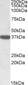 IHC-plus™ CNN3 Antibody (aa309-323)