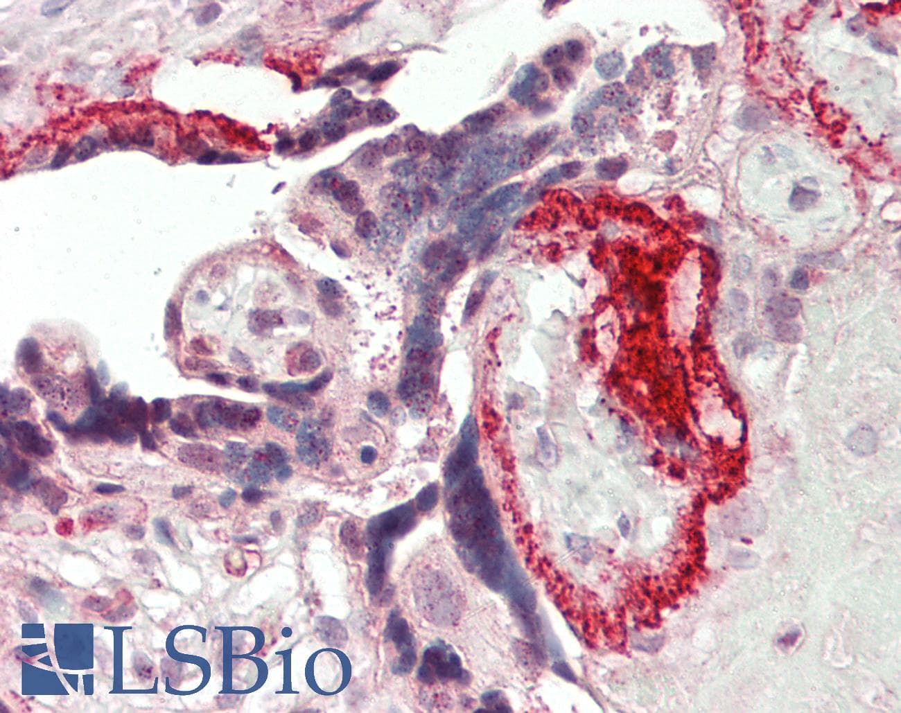 IHC-plus™ FBLN4 / EFEMP2 Antibody (aa91-140)