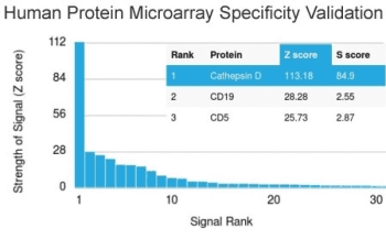 Monoclonal Mouse anti-Human CTSD / Cathepsin D Antibody (clone CTSD/2781, Ready-to-Use, IHC)