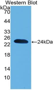 PARK7 / DJ-1 Antibody (aa1-189, PE)