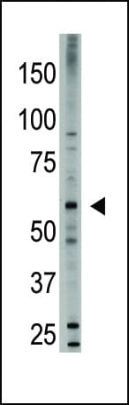 BMP6 Antibody (aa25-55)