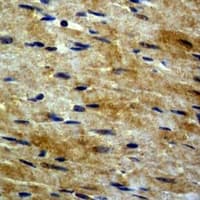 TUBB3 / Tubulin Beta 3 Antibody