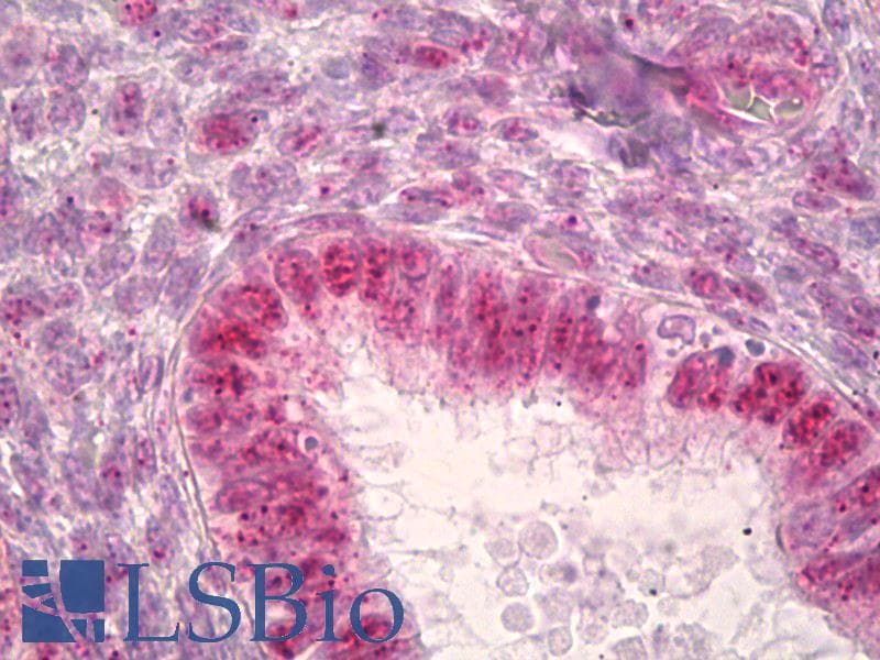 IHC-plus™ Polyclonal Rabbit anti-Human JUNB / JUN-B Antibody (aa226-275, IHC, WB)