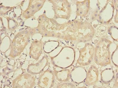 STK33 Antibody
