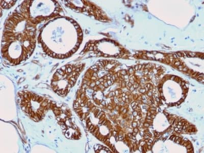 CTNNB1 / Beta Catenin Antibody (clone rCTNNB1/2173, Azide-free, Carrier-free)
