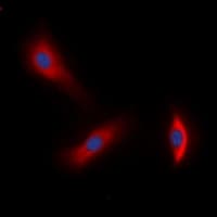 ERBB3 / HER3 Antibody (C-Terminus)