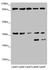Polyclonal Rabbit anti-Human MTHFD2 Antibody (IHC, WB)