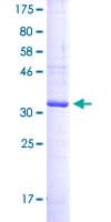 Human CD37 Protein (Recombinant GST, N-terminus)