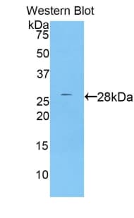 PRSS8 / Prostasin Antibody (aa33-272)