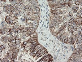 DPH2 Antibody (clone OTI2B12)